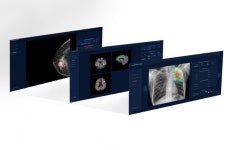 인공지능(AI) 기술 품은 국산 X-ray, 해외시장 개척