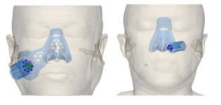 애니메디솔루션, 수술 가이드 솔루션 FDA 인증