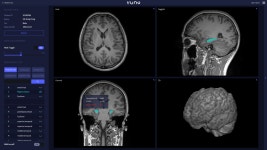 전세계 영상의학 최대 학술행사 2022 RSNA