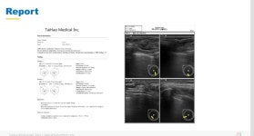대만 타이하오 유방암 진단 솔루션 국내 상륙