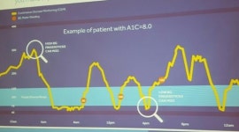메드트로닉 가치중심의료 실현할 제품 출시·개발 중