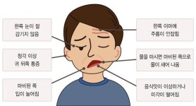 안면마비, 4명 중 1명 심각한 후유증 주의
