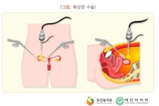 성장하는 영국 제약·의료기기, 韓 노인기기 겨냥