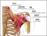 상완신경총 수술로 중풍 치료까지…연구는 계속