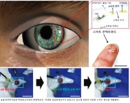 구글, 당뇨렌즈 개발 포기..국내 의료기기산업계 기회될까?