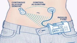 허가받지 않은 당뇨용 의료기기, 사용하지 마세요