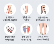 다가오는 겨울방학, 성장기 아동 발건강도 확인하세요