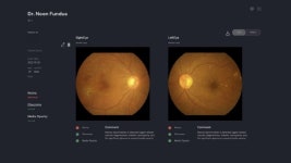 메디웨일 닥터눈 펀더스, 혁신의료기기 통합심사 승인
