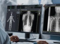 뷰웍스 의료영상 처리 소프트웨어 VXvue FDA 승인