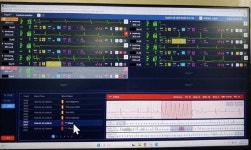 심정지 위기 막았다‥광주한국병원 씽크로 조기 대응