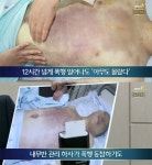 28사단 윤일병 사망, 수액까지 맞혀 가혹행위 사망 아닌 살인사건 경악