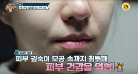 TV조선 팡팡터지는 정보쇼 알맹이, 피부관리 비법 스필란톨 소개