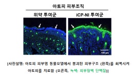 셀리버리, 면역염증치료제 iCP-NI 아토피 자가면역질환 치료제 임상개발 본격화