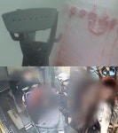궁금한 이야기y, 먹방BJ 수아씨 데이트 폭력 길체 다리미로 화상까지