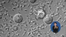 유산균, 아토피·관절염 등 ‘자가 면역 질환’ 치료