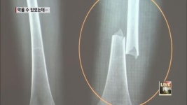 ‘8살 의붓딸 학대치사’ 2년 전 신고…막을 수 있었다