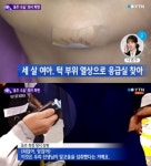 술 취한 의사 음주수술, 비틀거릴 정도로 취한 채 3살 짜리 어린아이 턱수술 집도?! 헐…XX거 아냐?