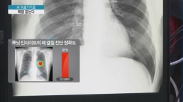 [점프업바이오] AI 의료기기 대세 루닛…루닛 인사이트로 폐암 잡는다