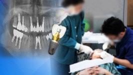 치과 임플란트, 건보 적용됐지만 불만 급증
