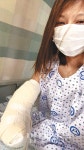 오른손 잃었지만 헤어디자이너 꿈 접을 수 없어