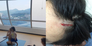 동구도서관서 아이 이마 찢어졌는데 같은 건물 동구보건소 무용지물
