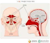 콧속 고름 제거하고 약만 먹어도 세상이 상쾌해져요