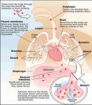부산시, 거주지 보건소에서 석면질환 검진 실시