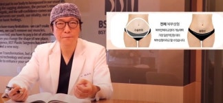 재수술 힘든 복부성형 꼼꼼한 봉합법으로 만족스러운 결과 가능