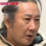 김도균 대장수술 결과…대장암 전 단계인 선종