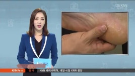 건강365-족저근막염