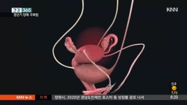 [건강365]갱년기 장애, 슬기롭게 극복하려면?