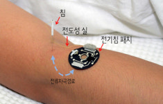 이젠 한방침도 ‘스마트’ 하세요~