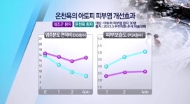 관절염엔 유황-아토피엔 식염철…내 몸에 맞는 ‘온천 선택법’