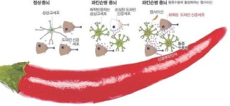 고추의 매운맛 캡사이신, 파킨슨병도 쫓아낸다