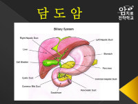 담도암 5년 생존율 20%…어떻게 알아채나?