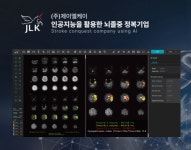 제이엘케이, KSEM 2024 참가 뇌졸중 풀 솔루션 AI 기술력 공개