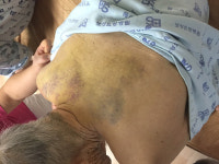 보성 요양병원 90대 치매환자 폭행 의혹 전말