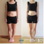 크리스마스 송년회, ‘걸그룹 주사’ MPL 주사로 몸매 걱정 해결하자!