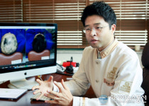 스트레스 받으면 ‘원형탈모’ 생긴다? 스트레스가 탈모 부른 이유는?