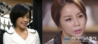 신이 나이, 양악수술 후 달라진 얼굴 비호감 이미지로 캐스팅 무산