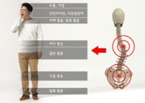 틀어진 체형 만드는 생활습관 턱관절통증