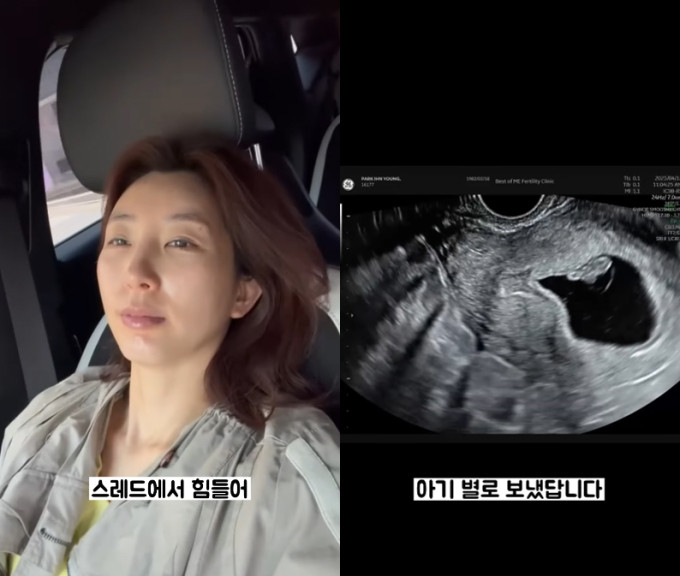 박인영, 유산 후 우울증 고통 고백…결혼 9주만에 심장 멈춤으로 괴로움