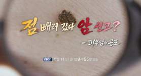 명의 오병호 교수와 피부암의 진실