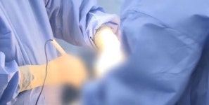 성형외과서 '지방흡입수술' 받던 중 20대 여성, 돌연 '사망'
