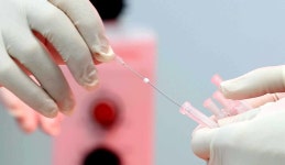 [인터뷰] 김양호 365엄지한방병원 원장 매선 침으로 통증 치료…경추·요추 추간판 탈출증 싹~