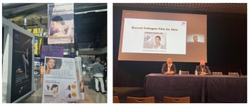 우신라보타치, AMWC 참가…콜라겐 구강점막 필름 연구발표