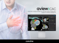 코어라인, 美하버-UCLA 메디칼센터와 AI 심장진단솔루션 공급계약