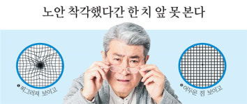 노안 착각했다간 한 치 앞 못 본다