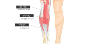 ‘종아리 콤플렉스’로 반바지 안 입던 김 과장이… 종아리 축소 위한 다양한 시술법