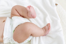 [소아에게 흔한 ‘서혜부 탈장’] 우리 아기 사타구니에 갑자기 혹 만져진다면